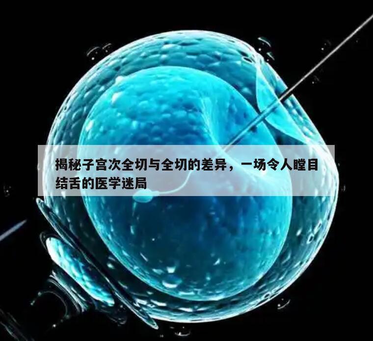 揭秘子宫次全切与全切的差异,一场令人瞠目结舌的医学迷局